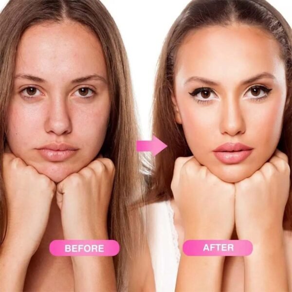 5 ديرما رولر